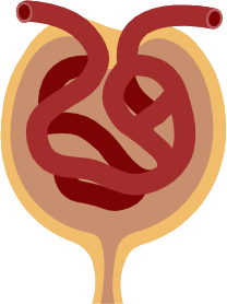 Chronic Kidney Disease Model